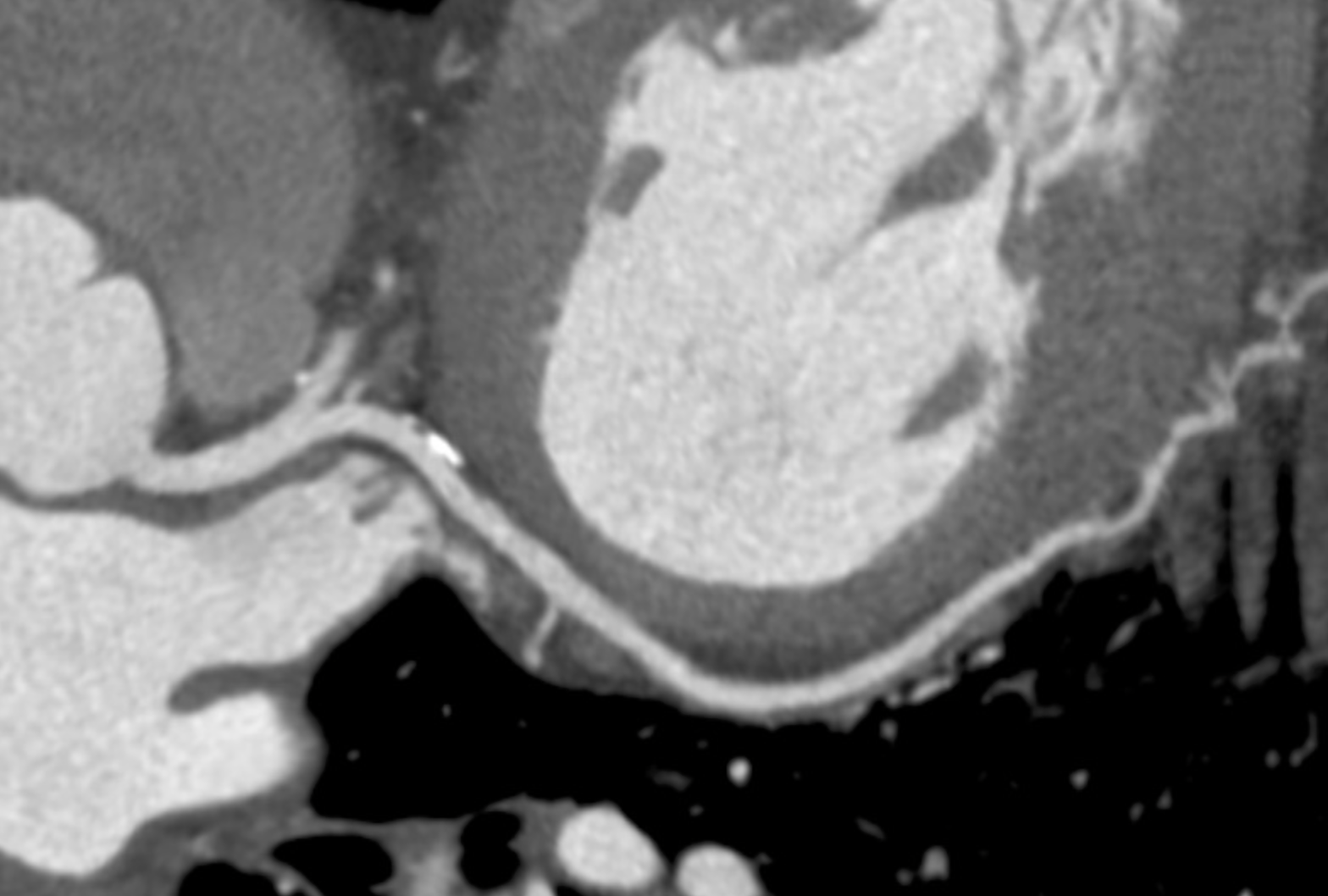 Coroscanner et scanner cardiaque au Centre Manin-Crimée